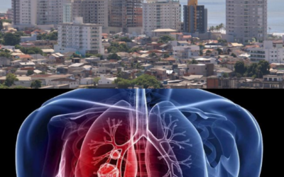 Navegantes integra estudo nacional sobre impacto da tuberculose