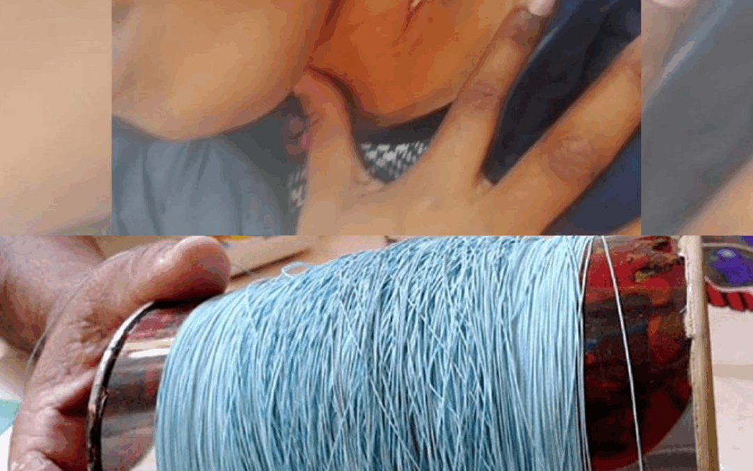 Mulher é ferida por cerol ao voltar pra casa de scooter em Itajaí: “Meu pescoço já estava indo pra trás”