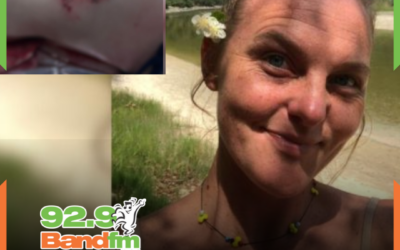 “Por pouco não perfura o intestino”, afirma mulher que foi mordida por capivara em Floripa