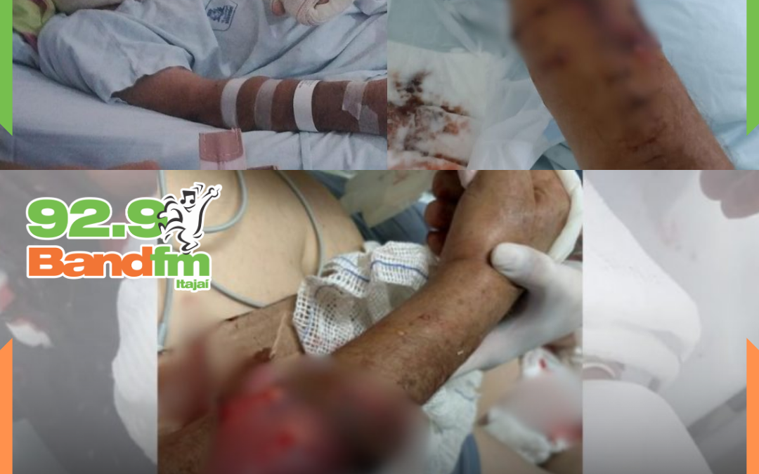 Idoso é atacado por pit bull em Joinville e afirma trauma: “ainda vejo o cachorro”