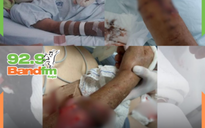 Idoso é atacado por pit bull em Joinville e afirma trauma: “ainda vejo o cachorro”